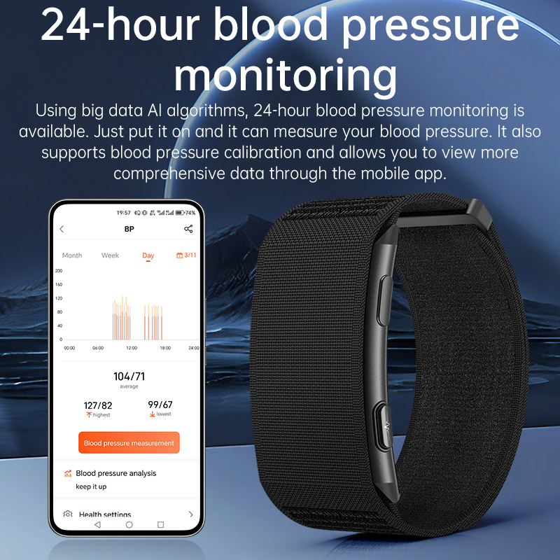 VWAR Loop X ECG Smart Bracelet - مراجعة Xbody Health & Wellness وسعره