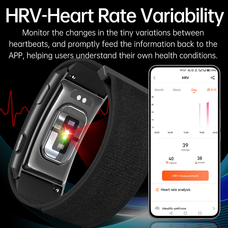 VWAR LOOP X ECG Smart Bracelet - مراجعة Xbody Health & Wellness وسعره